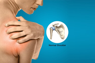Shoulder problems