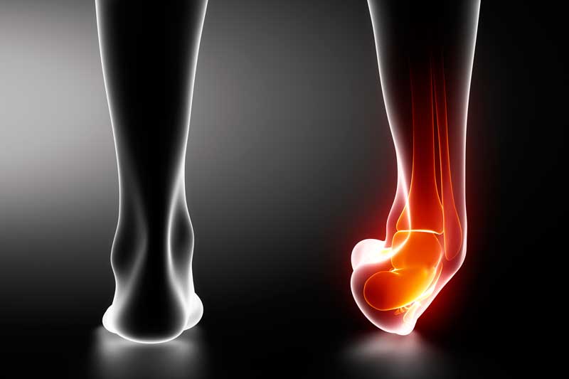Ankle injury