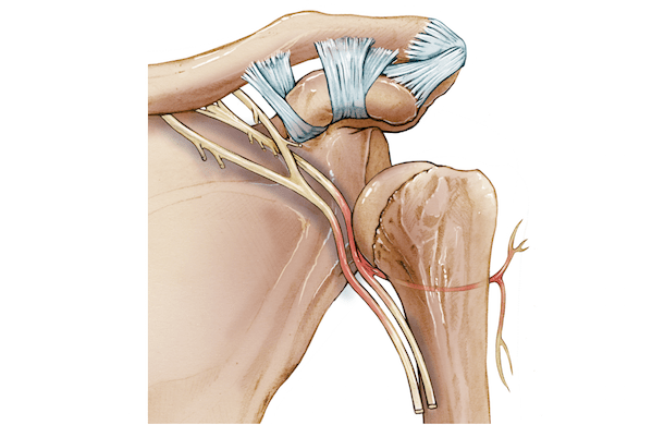 Axillary_Nerve_Injury