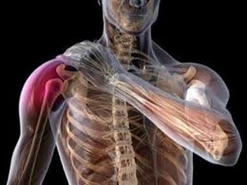 Tendinitis and Tendinosis