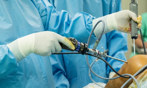 shoulder-arthroscopy