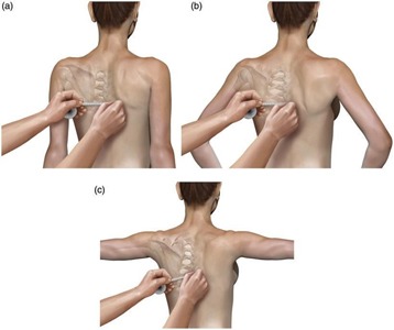 Lateral scapular slide test