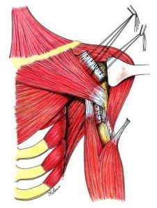 Muscle Transfer for Irreparable Tears