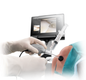 Nanoscope in Orthopedics