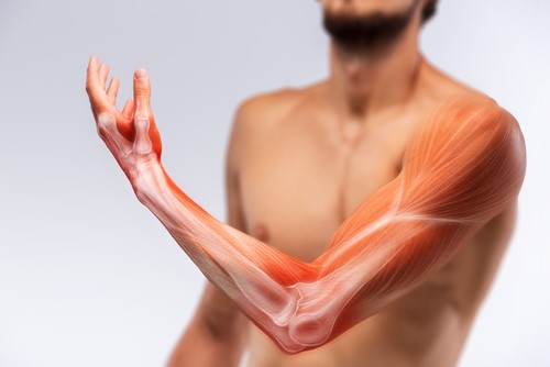 Musculoskeletal Disorders