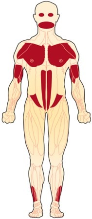 Facioscapulohumeral muscular dystrophy