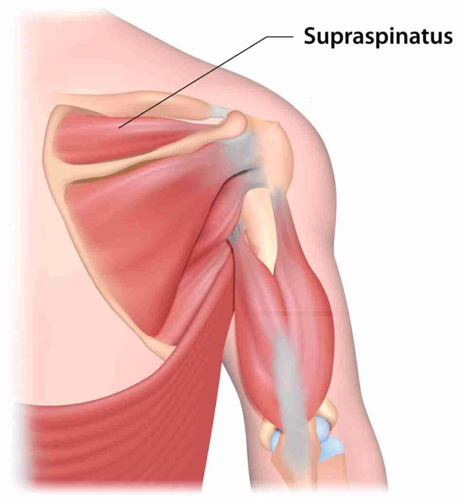 Supraspinatus Muscle Atrophy